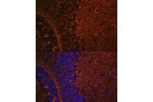 Immunofluorescence (IF) image for anti-Tubulin, beta 3 (TUBB3) antibody (ABIN7271049)