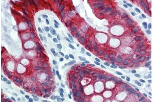 Colon, Human: Formalin-Fixed, Paraffin-Embedded (FFPE) (Cytokeratin 18 抗体)