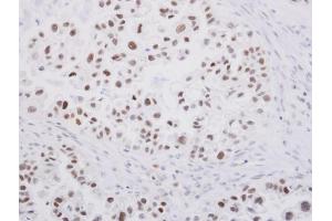 Immunohistochemistry (IHC) image for anti-Sp1 Transcription Factor (SP1) (C-Term) antibody (ABIN2855540)