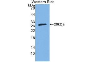 Western Blotting (WB) image for anti-SP140 Nuclear Body Protein (SP140) (AA 443-655) antibody (ABIN2119273) (SP140 抗体  (AA 443-655))