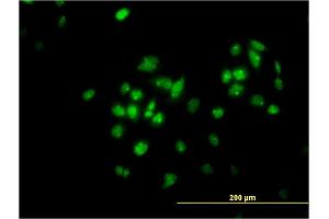 Immunofluorescence of monoclonal antibody to TFAP4 on HeLa cell. (TFAP4 抗体  (AA 93-192))