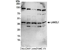 anti-LanC Lantibiotic Synthetase Component C-Like 1 (LANCL1) (AA 349-399) antibody