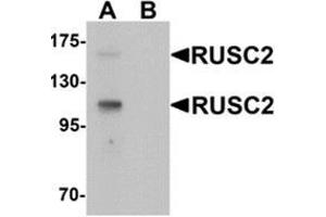 Western blot analysis of RUSC2 in SK-N-SH cell lysate with RUSC2 Antibody  at 1 ug/mL in (A) the absence and (B) the presence of blocking peptide