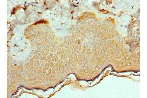 Immunohistochemistry of paraffin-embedded human skin tissue using ABIN7172544 at dilution of 1:100 (ETV6 抗体  (AA 1-300))