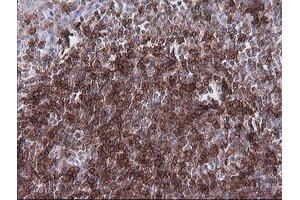 Immunohistochemistry (IHC) image for anti-T-cell surface glycoprotein CD1c (CD1C) antibody (ABIN2670667) (CD1c 抗体)
