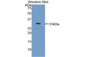 Western blot analysis of the recombinant protein. (ASK1 抗体  (AA 693-933))