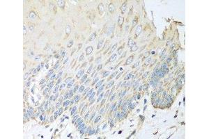 Immunohistochemistry of paraffin-embedded Human esophagus using SGCB Polyclonal Antibody at dilution of 1:100 (40x lens). (SGCB 抗体)