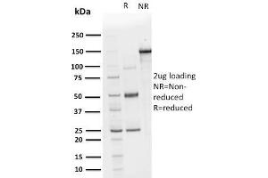 SDS-PAGE Analysis Purified CHP2 Mouse Monoclonal Antibody (CPTC-CHP2-1). (Chp2 抗体)