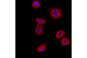 ABIN6264528 and ABIN6266732 staining Hela by IF/ICC. (PTTG1 抗体  (Internal Region))