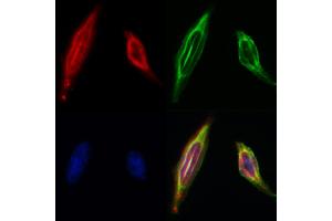 ABIN6260189 and ABIN6268682 staining Hela by IF/ICC. (BAG1 抗体  (N-Term))