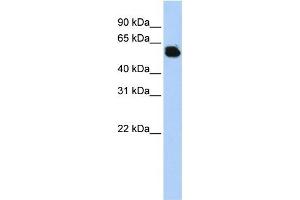 FTCD antibody used at 1 ug/ml to detect target protein. (FTCD 抗体  (Middle Region))