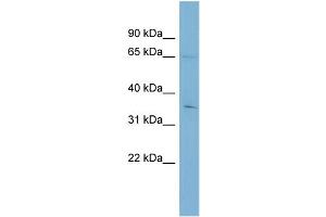 WB Suggested Anti-YTHDF1  Antibody Titration: 0. (YTHDF1 抗体  (Middle Region))