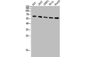 Western Blotting (WB) image for anti-ATP Synthase, H+ Transporting, Mitochondrial F1 Complex, alpha Subunit 1, Cardiac Muscle (ATP5A1) (Internal Region) antibody (ABIN7185948)