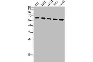 Western Blot analysis of 823 293T 22RV1 Hela HepG2 cells using ATP5A Polyclonal Antibody (ATP5A1 抗体  (Internal Region))