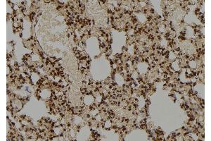 ABIN6276865 at 1/100 staining Rat lung tissue by IHC-P. (COPS5 抗体  (Internal Region))