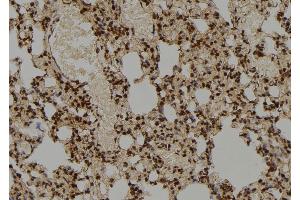 ABIN6276865 at 1/100 staining Rat lung tissue by IHC-P. (COPS5 抗体  (Internal Region))