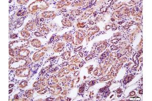Immunohistochemistry (IHC) image for anti-Protein Kinase, AMP-Activated, beta 1 Non-Catalytic Subunit (PRKAB1) (AA 201-272) antibody (ABIN751858)