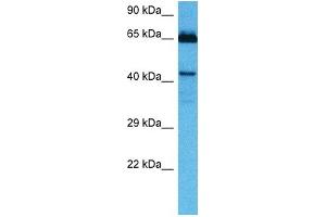 Host:  Mouse  Target Name:  HOXA10  Sample Tissue:  Mouse Kidney  Antibody Dilution:  1ug/ml (HOXA10 抗体  (Middle Region))