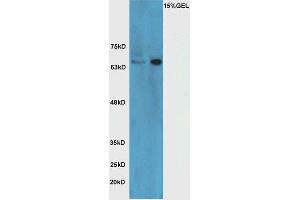 Lane 1: mouse brain lysate Lane 2: Raji cell lysate probed with Rabbit Anti-HRG beta 1 Polyclonal Antibody, Unconjugated (ABIN716051) at 1:300 overnight at 4 °C. (Hrg beta 1 (AA 65-150) 抗体)