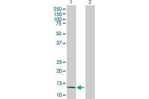 Lane 1: SLURP1 transfected lysate ( 11. (SLURP1 293T Cell Transient Overexpression Lysate(Denatured))