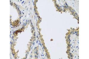 Immunohistochemistry of paraffin-embedded Human prostate using GFER Polyclonal Antibody at dilution of 1:100 (40x lens). (GFER 抗体)