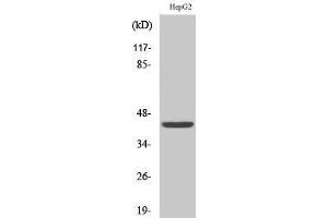 Western Blotting (WB) image for anti-FGFR1 Oncogene Partner (FGFR1OP) (C-Term) antibody (ABIN3184647) (FGFR1OP 抗体  (C-Term))