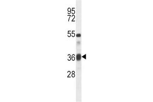Western Blotting (WB) image for anti-Transforming Growth Factor, beta 1 (TGFB1) antibody (ABIN5016291) (TGFB1 抗体)