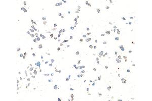 Immunocytochemistry (ICC) image for anti-Syndecan 1 (SDC1) (AA 23-251) antibody (ABIN7795740)