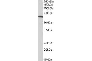 ABIN2564355 (0. (RPS6KB1 抗体  (C-Term))