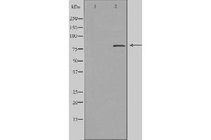 Western blot analysis of extracts from COS cells, using ZC11A antibody. (ZC3H11A 抗体  (C-Term))