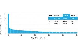 Analysis of Protein Array containing more than 19,000 full-length human proteins using ZFYVE28 Mouse Monoclonal Antibody (LST2/2426) Z- and S- Score: The Z-score represents the strength of a signal that a monoclonal antibody (Monoclonal Antibody) (in combination with a fluorescently-tagged anti-IgG secondary antibody) produces when binding to a particular protein on the HuProtTM array. (ZFYVE28 抗体)