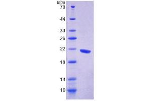 SDS-PAGE analysis of Human GFM1 Protein. (GFM1 蛋白)