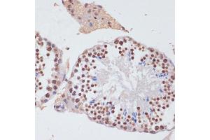 Immunohistochemistry (IHC) image for anti-Histone 3 (H3) (C-Term) antibody (ABIN3023243)