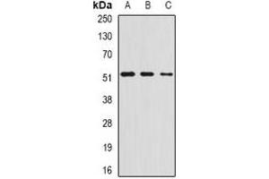 Western blot analysis of AMCase expression in HepG2 (A), mouse stomach (B), rat lung (C) whole cell lysates. (CHIA 抗体)