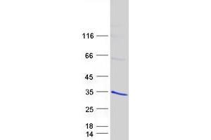 Validation with Western Blot