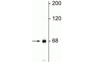 Western blot of rat cortical lysate showing specific immunolabeling of the ~68 kDa NF-L protein. (NEFL 抗体)