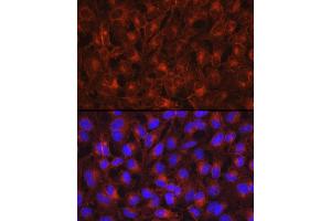 Immunofluorescence analysis of HeLa cells using Axl Rabbit pAb (ABIN7265804) at dilution of 1:200 (40x lens).