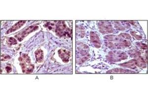 Immunohistochemistry (IHC) image for anti-B-Cell CLL/lymphoma 10 (BCL10) antibody (ABIN1105500) (BCL10 抗体)