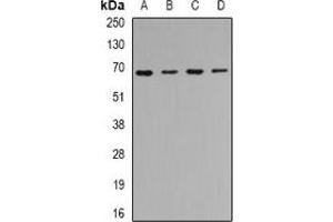 Western blot analysis of CIP4 expression in Hela (A), SKOV3 (B), mouse kidney (C), mouse heart (D) whole cell lysates. (TRIP10 抗体)