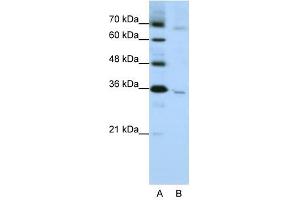 Western Blotting (WB) image for anti-Wingless-Type MMTV Integration Site Family, Member 5B (WNT5B) (C-Term) antibody (ABIN630136)