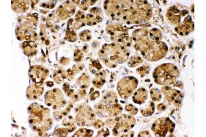 Immunohistochemistry (Paraffin-embedded Sections) (IHC (p)) image for anti-Parkinson Protein 7 (PARK7) (AA 2-189) antibody (ABIN3043589) (PARK7/DJ1 抗体  (AA 2-189))