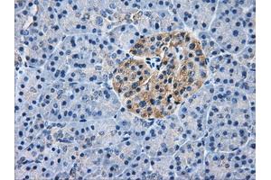 Immunohistochemistry (IHC) image for anti-Aldo-Keto Reductase Family 1, Member A1 (Aldehyde Reductase) (AKR1A1) antibody (ABIN1496543) (AKR1A1 抗体)