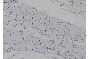 ABIN6263351 and ABIN6277272 at 1/100 staining Human gastric tissue by IHC-P. (Mre11 抗体  (C-Term))
