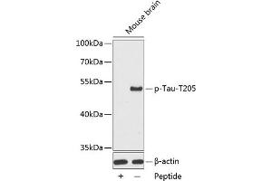 Western blot analysis of extracts from mouse brain tissue, using phospho-Tau-T205 antibody (ABIN3019697, ABIN3019698, ABIN3019699 and ABIN7101862). (MAPT 抗体  (pThr205))