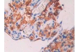 Detection of CA7 in Mouse Ovary Tissue using Polyclonal Antibody to Carbonic Anhydrase VII (CA7) (CA7 抗体  (AA 58-217))