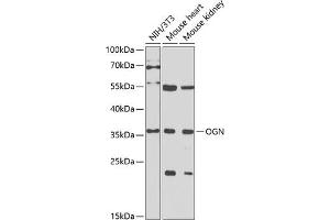Western blot analysis of extracts of various cell lines, using OGN antibody (ABIN6131952, ABIN6145008, ABIN6145009 and ABIN6222384) at 1:1000 dilution. (OGN 抗体  (AA 20-298))