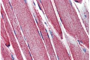 Skeletal muscle, Human: Formalin-Fixed, Paraffin-Embedded (FFPE) (SOD2 抗体)