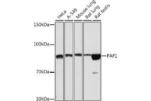Western blot analysis of extracts of various cell lines, using P Rabbit mAb (ABIN7269152) at 1:1000 dilution. (PAF1/PD2 抗体)