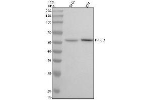 Western blot analysis of P-IRF3 using anti-P-IRF3 antibody (ABIN7603322).