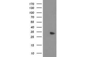 Western Blotting (WB) image for anti-Myeloid Differentiation Primary Response Gene (88) (MYD88) antibody (ABIN1499612) (MYD88 抗体)
